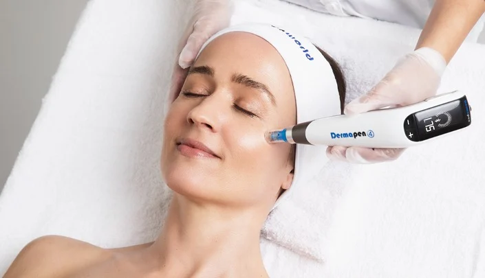 Microneedling with Dermapen