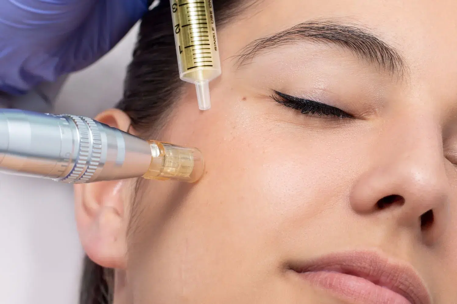 Exosomes Skin Treatment