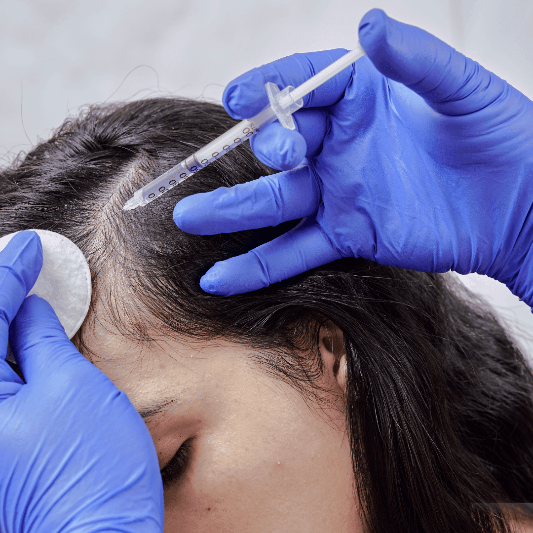 GFC Hair Treatment