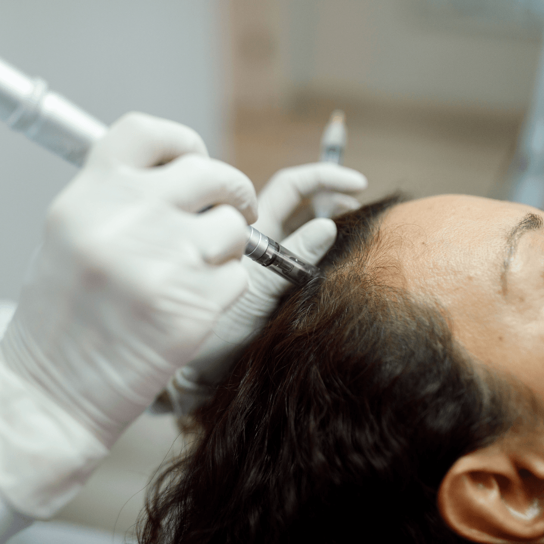 Exosomes Hair Treatments
